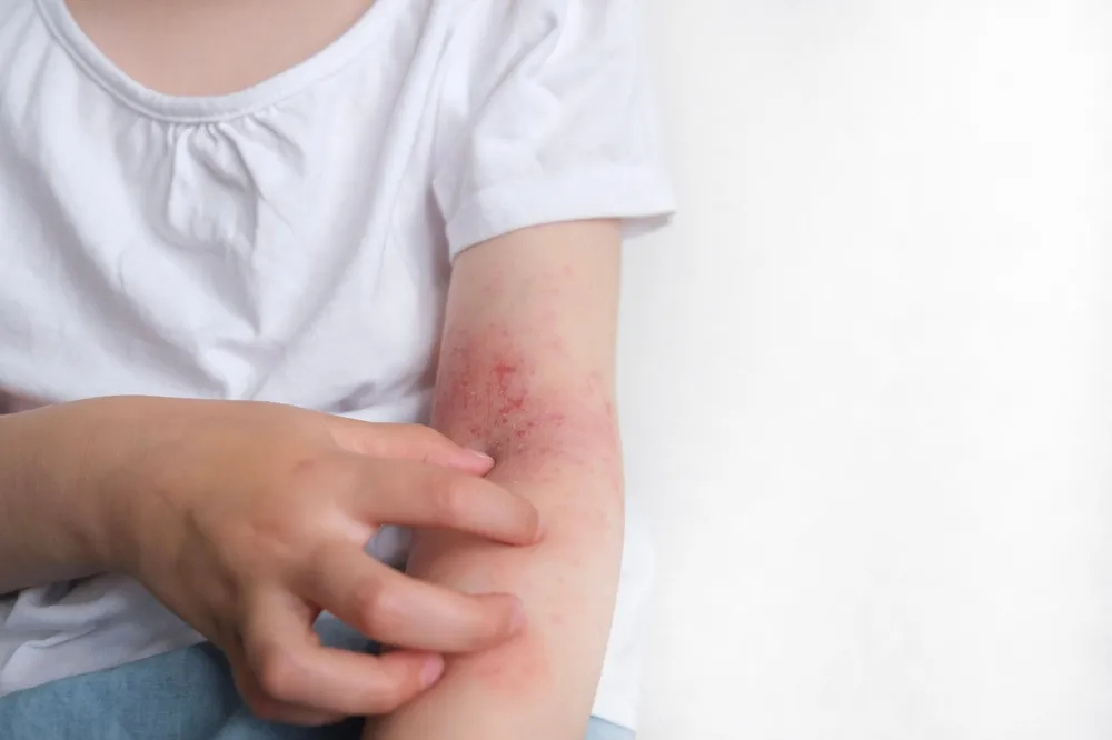 Health Hazards Caused by Pests in Buildings